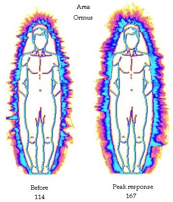 Example "Aura" images Example "Aura" images