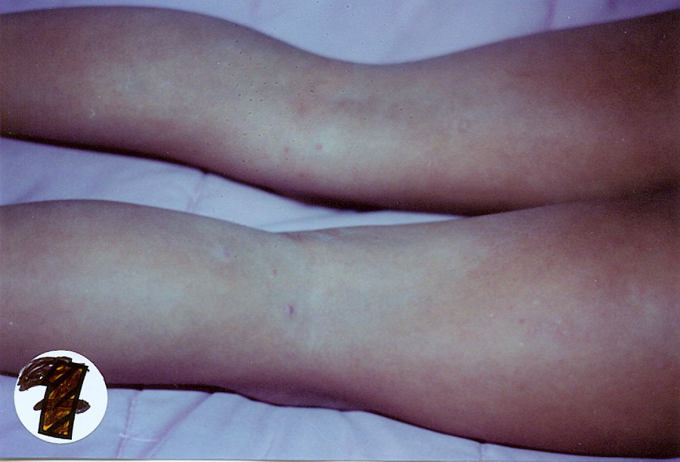 pox7.jpg pox7.jpg